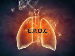EPOC